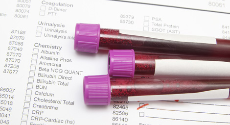 Three vials of blood to be tested